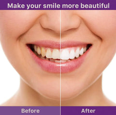 Smile Ease | ابتسامة سهولة
